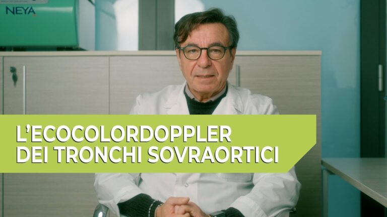 Comprendere il TSA: Definizione e Implicazioni