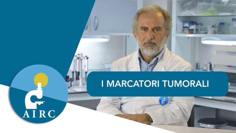 Esame CEA: Cos’&egrave; e Perch&eacute; &Egrave; Importante